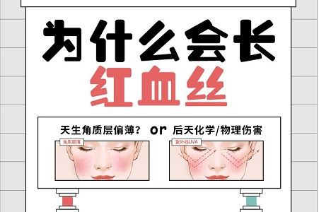 红血丝大解密：教你怎样有效去除脸上的红血丝