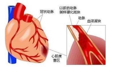 肌肉跳动的原因及应对方法：从睡眠不足到糖尿病的全面解析