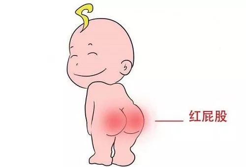 宝宝红屁股怎么办：生活调理与药物治疗的全方位指南