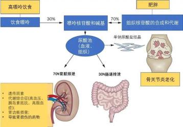 高尿酸血症：症状、影响与防治全解析