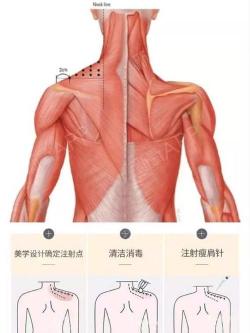 斜方肌：位置、功能与重要性