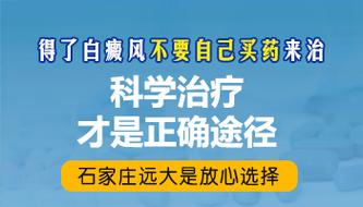 白癜风吃什么药：探索白癜风治疗药物的种类与作用