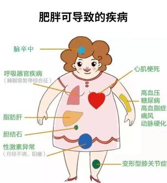 儿童肥胖症：原因、影响与应对方法