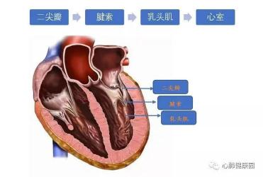 二尖瓣轻度狭窄：了解症状、诊断与治疗