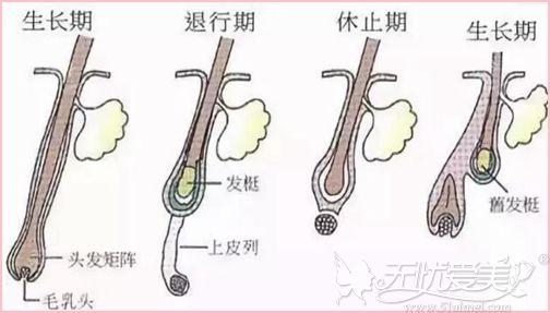 激光脱毛后，毛发还会再长吗？专业解答与指南