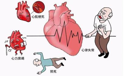 心梗揭秘：年轻人也需要警惕的心脏危机