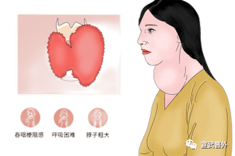 烦躁情绪揭秘：生理、心理与甲状腺的影响