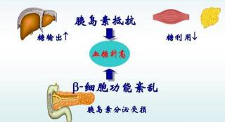 胰岛素：生命的调控者，探索糖尿病治疗的秘密武器