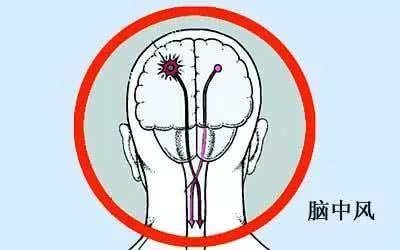 大病前兆：嗜睡或是身体发出的警示信号