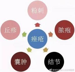 战胜痤疮结节：实用治疗方法助你重拾光滑肌肤