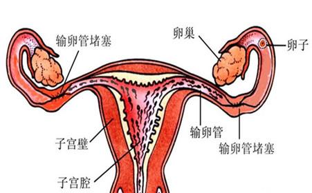 什么是卵巢囊肿？一文带你了解女性常见疾病