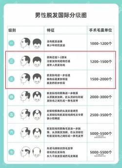 毛囊移植：解决脱发困扰，重塑自信魅力