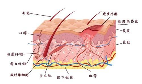 如何治疗疤痕：从光疗法到自然疗法，探索最有效的去疤方案