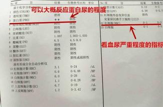 碱性磷酸酶正常值：儿童与成人的参考范围及健康解读