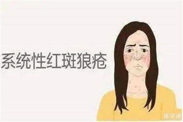 什么是红斑狼疮：症状、原因与应对策略