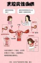 细菌性阴道病：症状、原因与防治，女性健康需关注