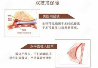 安全隆胸法：假体与自体脂肪隆胸的优选