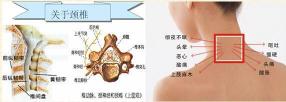 颈椎骨刺增生的症状与治疗方法：守护您的颈椎健康