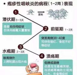 鹅口疮：小儿口腔疾病的成因、症状与治疗方法