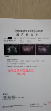 甲状腺癌根治术：从诊断到治疗，全面解析治愈之路