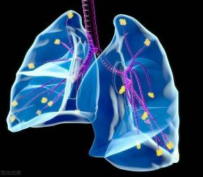 肺部有炎症：能否自愈？治疗与恢复的关键