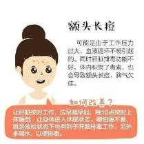 痤疮：是什么引起的？如何预防和应对？