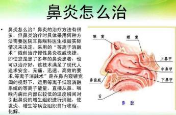 如何治疗过敏性鼻炎：综合方法与有效控制