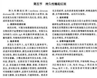 系统性红斑狼疮诊断：专业方法与鉴别要点