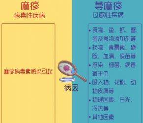 慢性荨麻疹会传染吗？答案是：不会