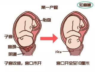 宫缩是什么？了解分娩前的重要征兆