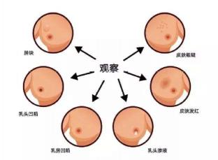 分泌物发黄：生理原因与病理性原因分析