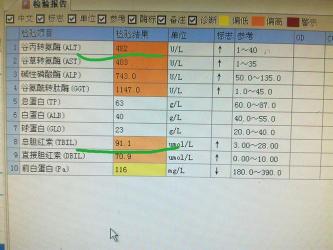 血清碱性磷酸酶在黄疸、肝硬化和胆管癌诊断中的应用