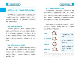 如何治疗近视：多种方法助你恢复视力