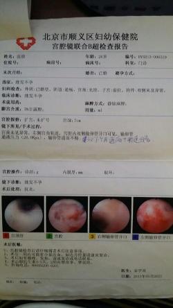 宫外孕手术：类型、方法和最佳治疗选择