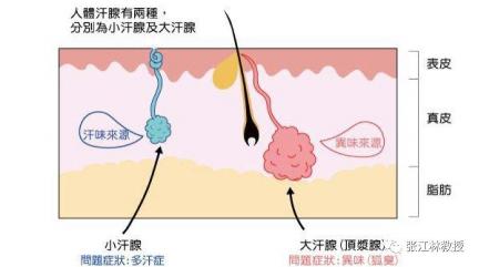 摆脱尴尬，有效治疗腋臭的几种方法