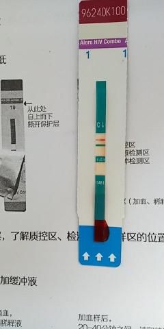 HIV检测试纸：使用方法与准确度评估