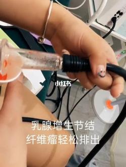 乳腺纤维瘤微创手术：治疗与护理指南