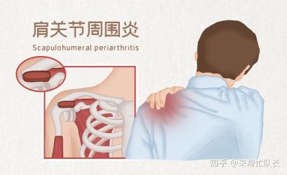 背痛是怎么回事？四方面原因解析